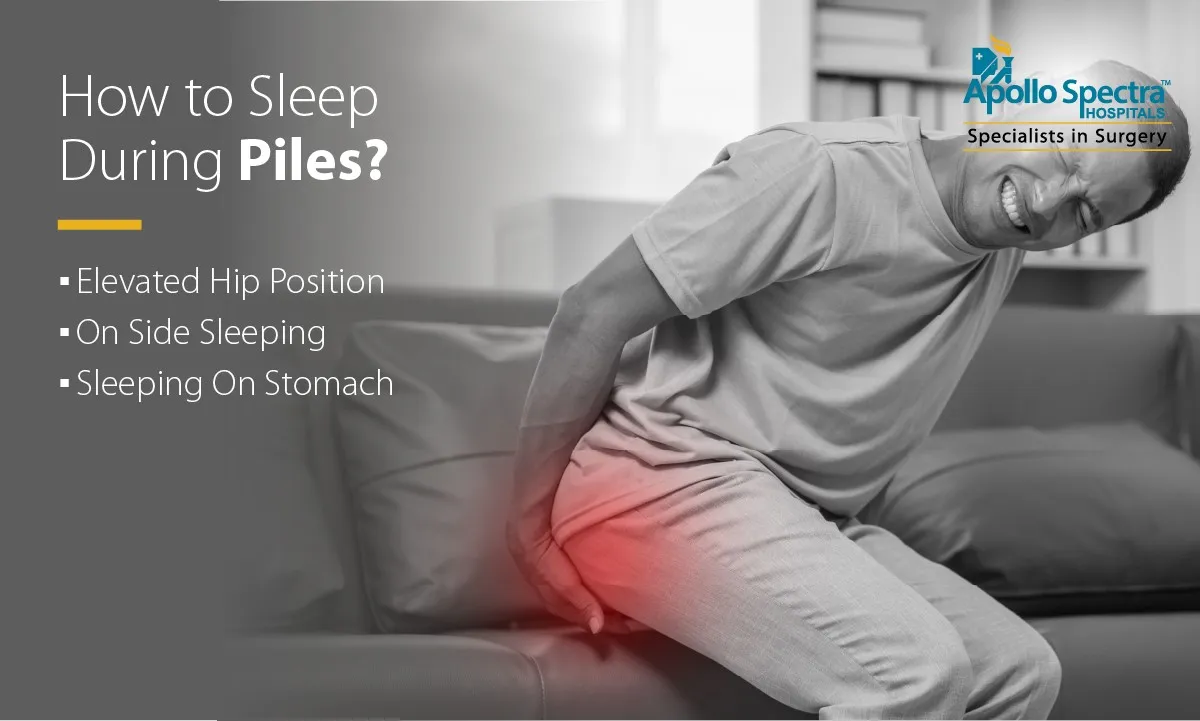 How To Sleep During Piles?